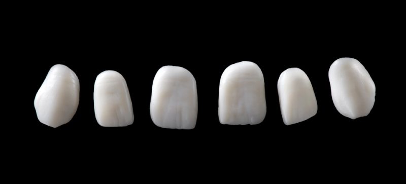 SILICONE MOULDS, ANTERIOR - Image 2