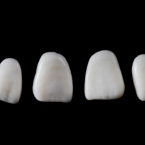 SILICONE MOULDS, ANTERIOR - Image 3