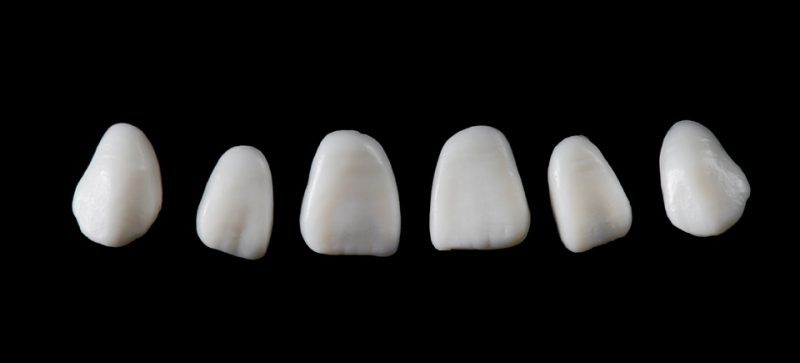 SILICONE MOULDS, ANTERIOR - Image 3