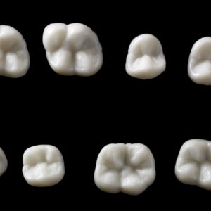 SILICONE MOULDS, POSTERIOR - Image 2