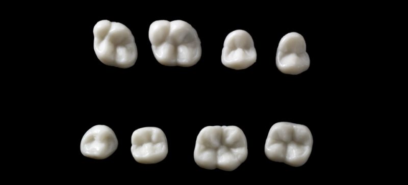 SILICONE MOULDS, POSTERIOR - Image 2