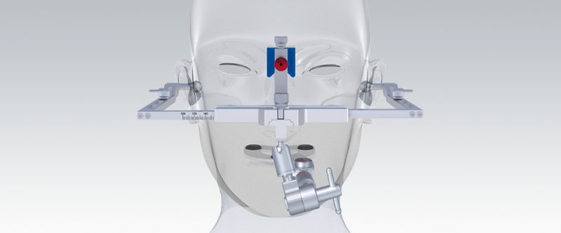 Artex® Facebow