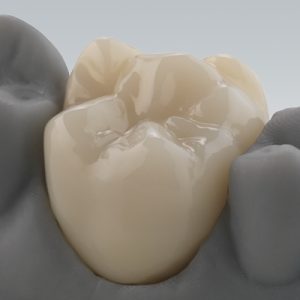 dental zirconia in jordan