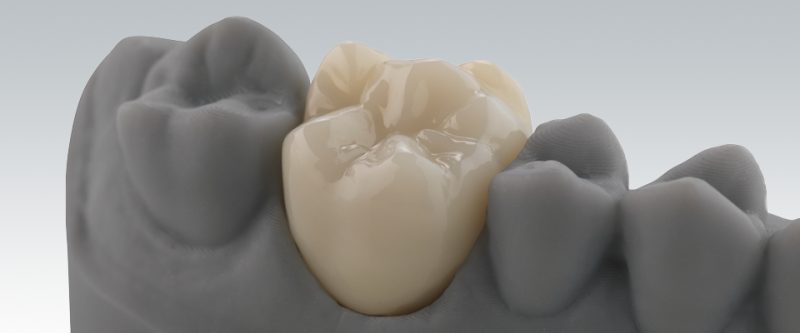 dental zirconia in jordan