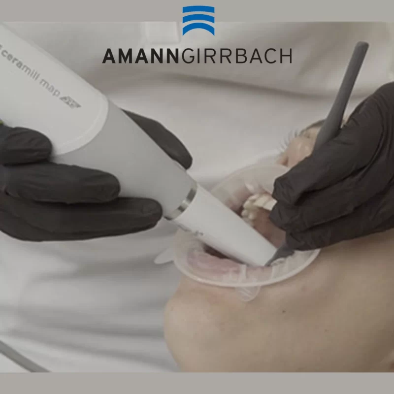 intraoral scanner