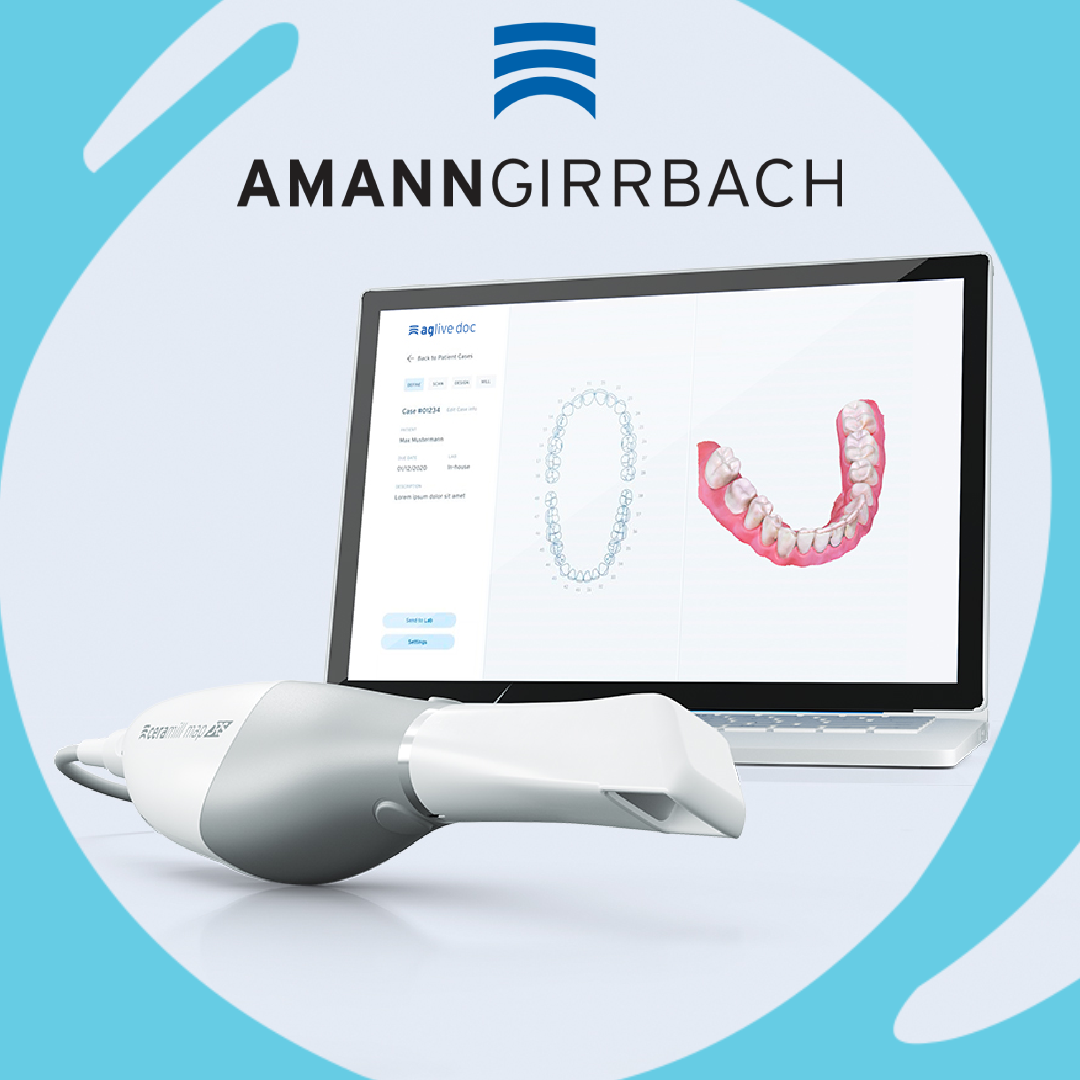 intraoral scanner